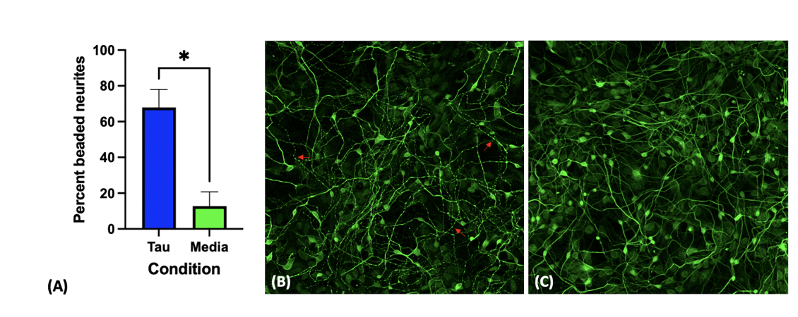 Aging and Alzheimer’s disease across primate species