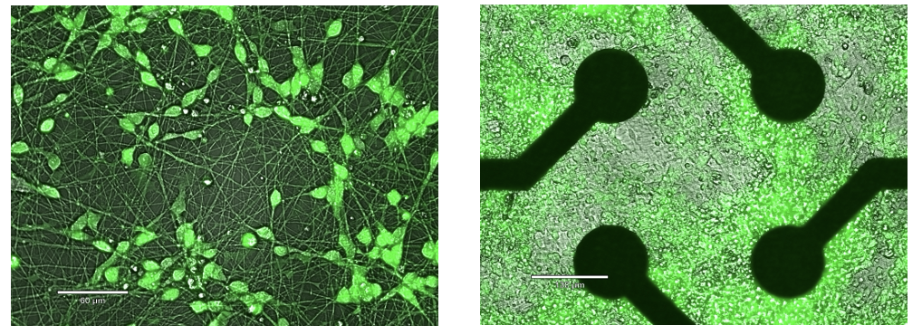 Microplastics exposure impact on human brain development